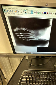 Digital Podiatry X-Ray System (Preowned)