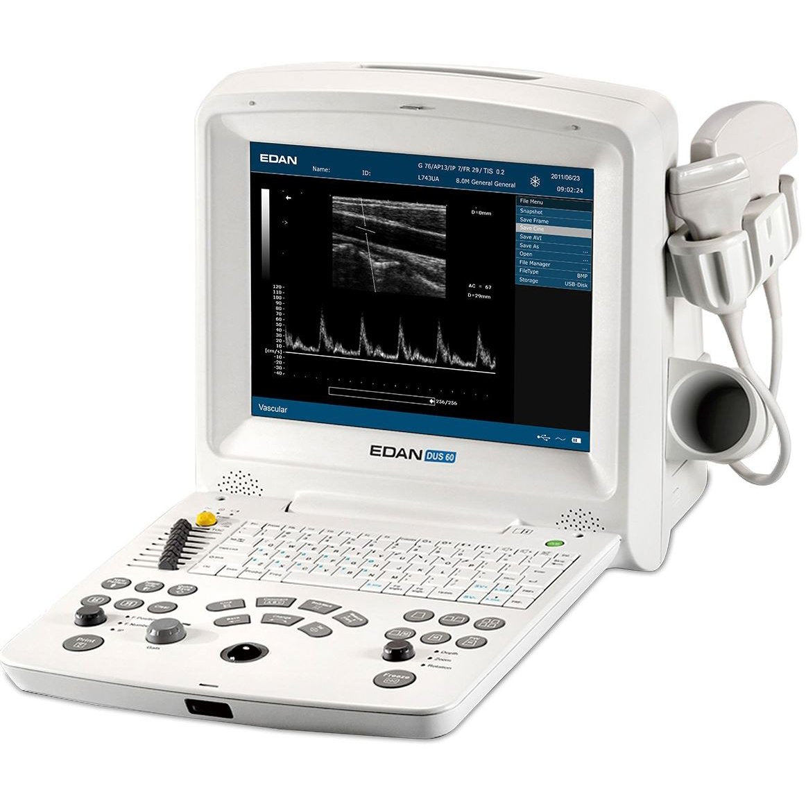 Edan DUS 60 Ultrasound